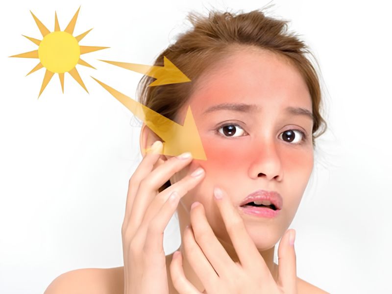 7 Bí Quyết Chăm Sóc Da Khô Nắng Gắt Chuyển Mùa Rạng Rỡ 3 bí quyết chăm sóc da khô nắng gắt chuyển mùa